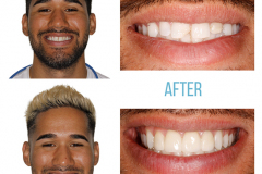 Juan Before/After