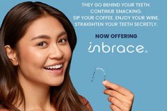 orthodontics-inbrace-gilbert-az-dentist